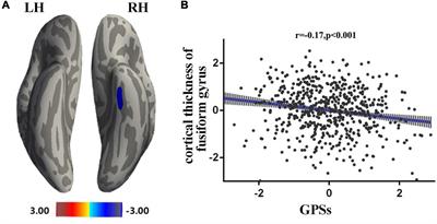 Effects of the Openness to Experience Polygenic Score on Cortical Thickness and Functional Connectivity